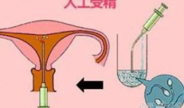 人工授精视频,科技助力生育新篇章